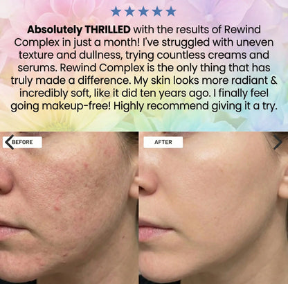 The Nuva Complete System